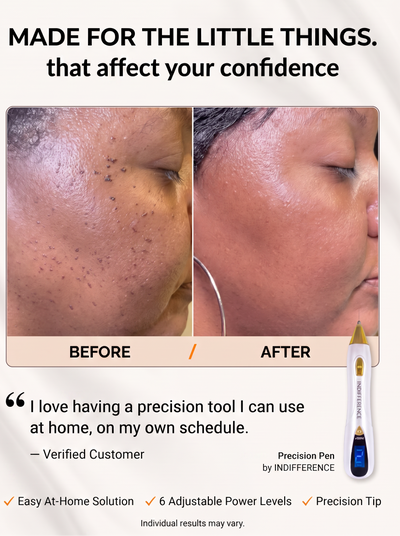 Skin tags Removal Pen