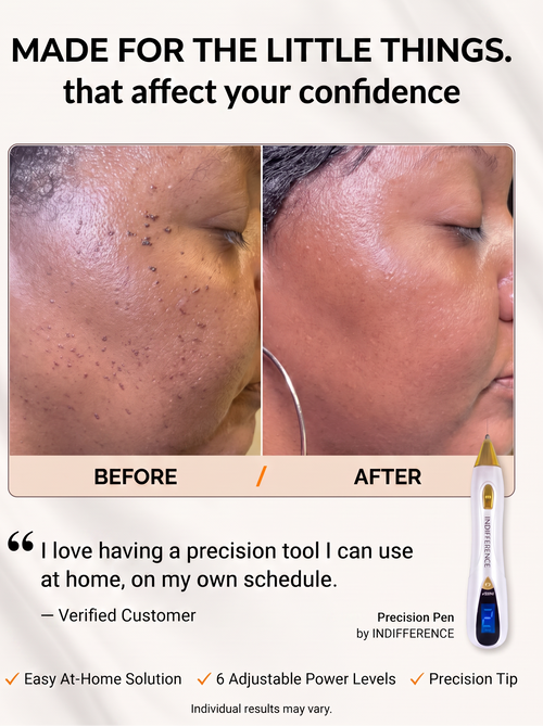 Skin tags Removal Pen